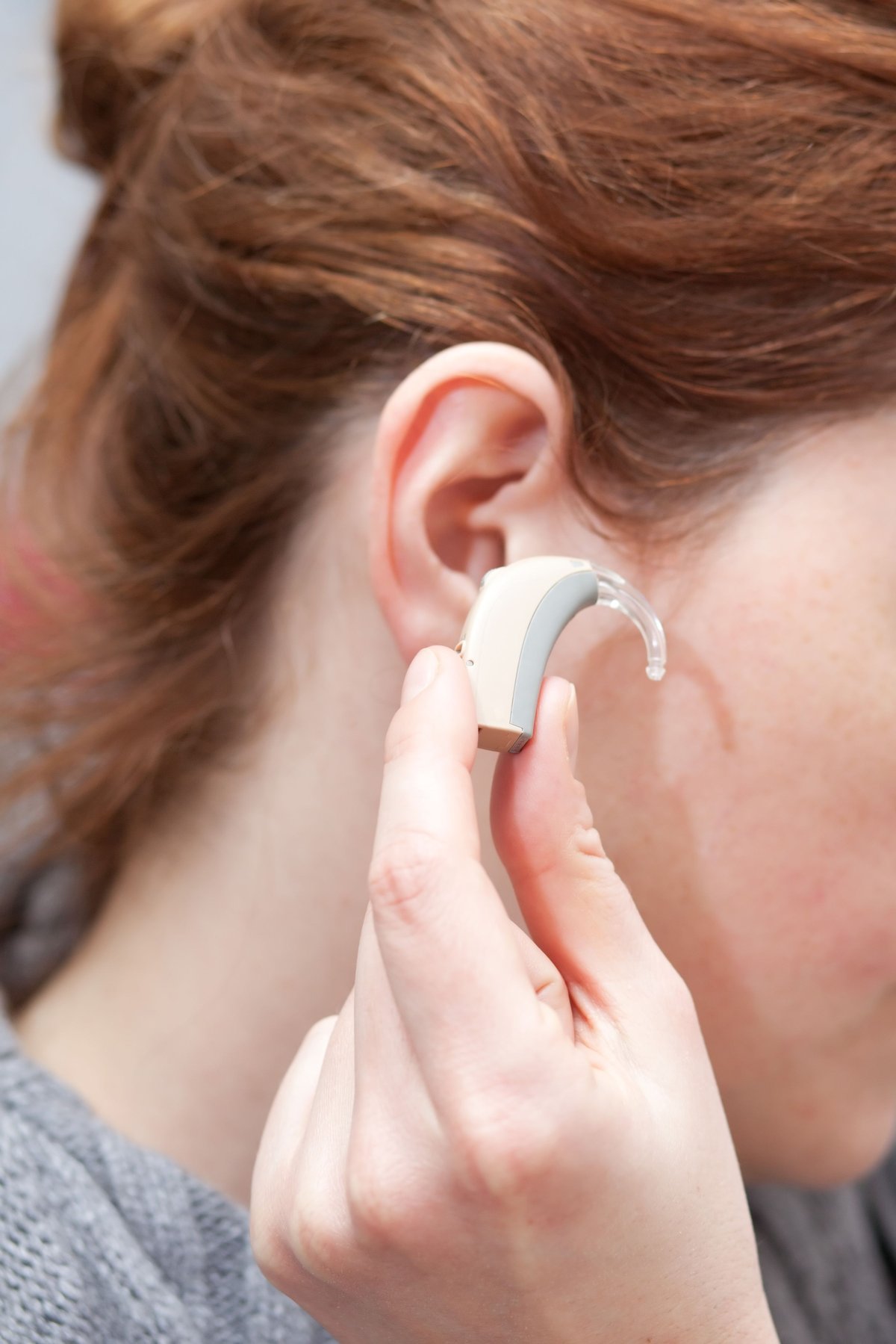 Utrafine Insulated Wire in Hearing Aids Utrafine Insulated Wire in medical aids